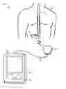 Fig. 01 - Failsafe programming of implantable medical devices