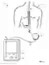 Fig. 02 - Failsafe programming of implantable medical devices