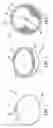 Fig. 02 - Device and method for stabilization of eye during eye surgery