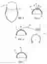 Fig. 03 - Device and method for stabilization of eye during eye surgery