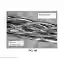 Fig. 04 - Braided electrical lead