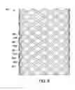 Fig. 06 - Braided electrical lead