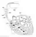 Fig. 01 - Cardiac lead implantation system