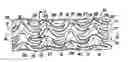 Fig. 01 - Metal stent with surface layer of noble metal oxide and method of fabrication