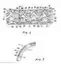 Fig. 02 - Metal stent with surface layer of noble metal oxide and method of fabrication