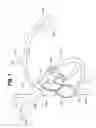 Fig. 02 - Intravascular implantable device having detachable tether arrangement