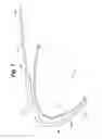 Fig. 08 - Intravascular implantable device having detachable tether arrangement