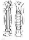 Fig. 04 - Intraluminal Graft