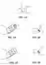 Fig. 03 - Prosthesis Deployment Apparatus and Methods