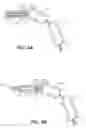 Fig. 04 - Prosthesis Deployment Apparatus and Methods