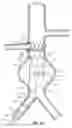 Fig. 08 - Prosthesis Deployment Apparatus and Methods