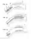 Fig. 02 - Endoprosthesis with coatings