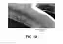 Fig. 09 - Endoprosthesis with coatings