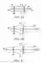 Fig. 06 - Instrument and method for in situ deployment of cardiac valve prostheses