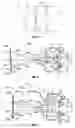 Fig. 04 - Vertebral implant containment device and methods of use