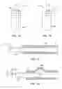 Fig. 08 - Percutaneous spinal implants and methods