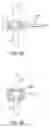 Fig. 13 - Percutaneous spinal implants and methods
