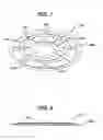 Fig. 04 - Implantable repair device