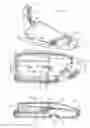 Fig. 03 - Prosthetic vacuum system