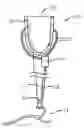 Fig. 01 - Prosthetic socket with real-time dynamic control of pressure points