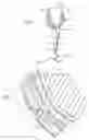 Fig. 02 - Prosthetic socket with real-time dynamic control of pressure points