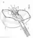 Fig. 08 - Cable feeding device with indicator