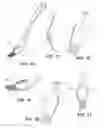 Fig. 07 - Created spoon-fork and spoon-knife