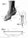 Fig. 02 - Protective foot covering article