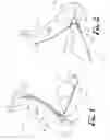 Fig. 02 - Adjustable bridle