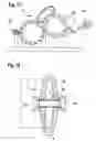 Fig. 10 - Microwave resonator for or on a textile machine, especially a card, draw frame, combing machine or the like
