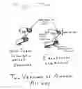 Fig. 03 - Awake airway, including two variants