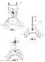Fig. 02 - APPARATUS FOR LEG ABDUCTION