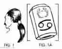 Fig. 02 - Bowman