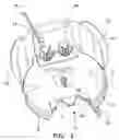 Fig. 03 - Self cutting electrical outlet box