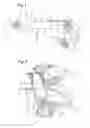 Fig. 02 - Device allowing for the individual distribution of small stick-shaped objects
