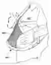 Fig. 01 - Carrying Device