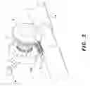 Fig. 03 - Anti-backlash device