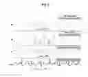 Fig. 03 - System and method for determining application of adaptive filter
