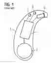 Fig. 02 - Hearing instrument with parameter resetting and corresponding method