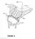 Fig. 08 - Headset with interchangeable ear pieces