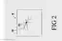 Fig. 03 - Radial adaptive filter for metal artifact correction