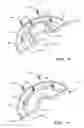 Fig. 06 - Pump wet end replacement method and impeller fixing mechanism