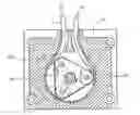 Fig. 01 - INFILTRATION PUMP HAVING INSULATED ROLLERS AND PROGRAMMABLE FOOT PEDAL