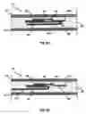 Fig. 06 - Integrated analysis device which can be fitted to a container housing a sample to be analyzed