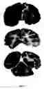 Fig. 41 - Genetically encoded multifunctional compositions bidirectionally transported between peripheral blood and the cns