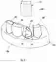 Fig. 06 - Implant abutment clips