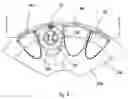 Fig. 09 - Implant abutment clips