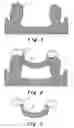 Fig. 02 - Method for manufacturing a dental prosthesis and an appliance for implantation thereof