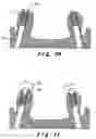 Fig. 06 - Method for manufacturing a dental prosthesis and an appliance for implantation thereof