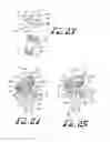 Fig. 06 - Dental attachment assembly and method